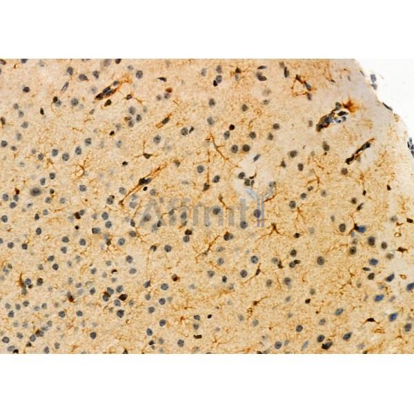 OLFM1 Antibody - DF6064 at 1/100 staining Mouse brain tissue by IHC-P.