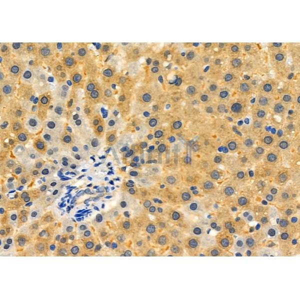 TBRG4 Antibody - DF6079 at 1/100 staining Rat liver tissue by IHC-P.