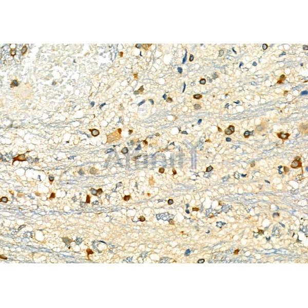 MAD2L1 Antibody - DF6562 at 1/100 staining Rat brain tissue by IHC-P.
