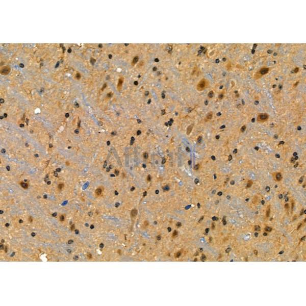 PSMD10 Antibody - DF6713 at 1/100 staining Mouse brain tissue by IHC-P.