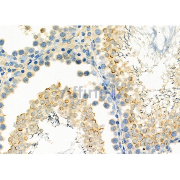 NR1I3 Antibody - DF6725 at 1/100 staining Rat testis tissue by IHC-P.