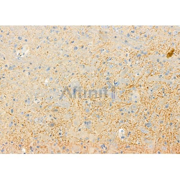 IL1RN Antibody - DF6812 at 1/100 staining Rat brain tissue by IHC-P.