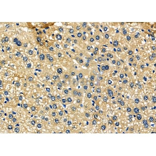 SCCPDH Antibody - DF6871 at 1/100 staining Mouse liver tissue by IHC-P.