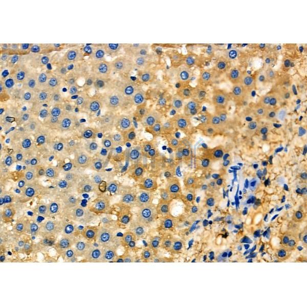 SCCPDH Antibody - DF6871 at 1/100 staining Rat liver tissue by IHC-P.