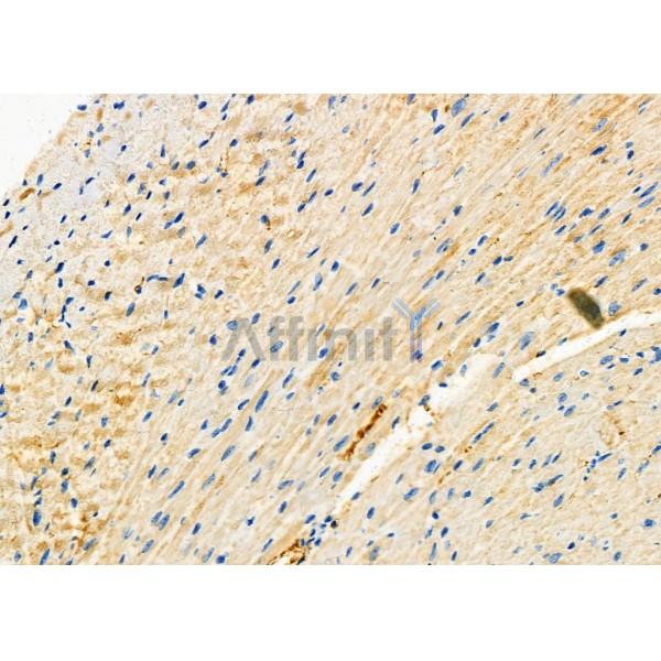 PIWL1 Antibody - DF6873 at 1/100 staining Mouse heart tissue by IHC-P.