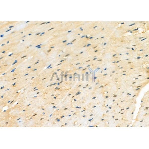 PSMA2 Antibody - DF6972 at 1/100 staining Rat heart tissue by IHC-P.