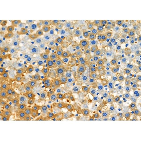 USO1 Antibody - DF7086 at 1/100 staining Rat liver tissue by IHC-P.