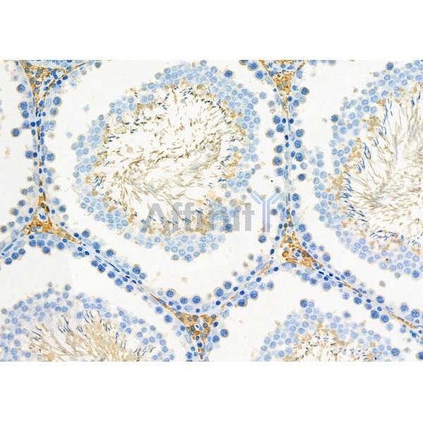 LRPAP1 Antibody - DF7141 at 1/100 staining Rat testis tissue by IHC-P.
