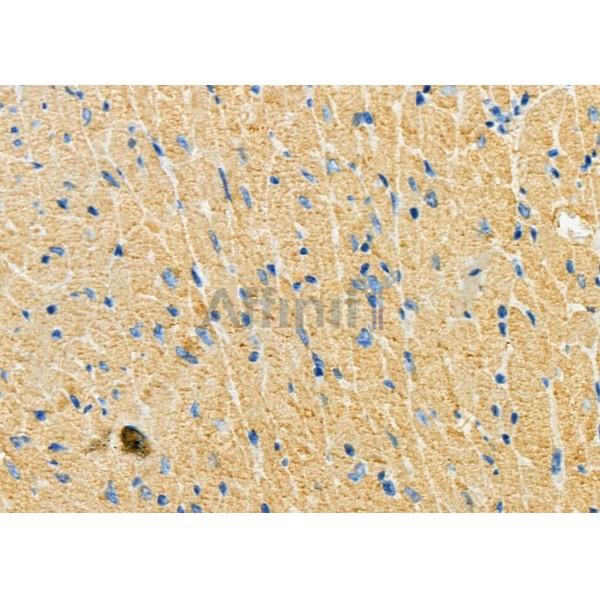 SLC1A4 Antibody - DF7178 at 1/100 staining Mouse heart tissue by IHC-P.