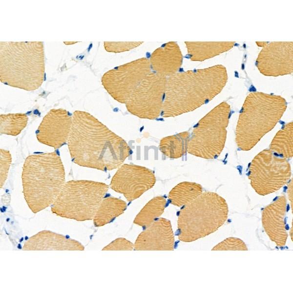 SLC1A4 Antibody - DF7178 at 1/100 staining Mouse muscle tissue by IHC-P.