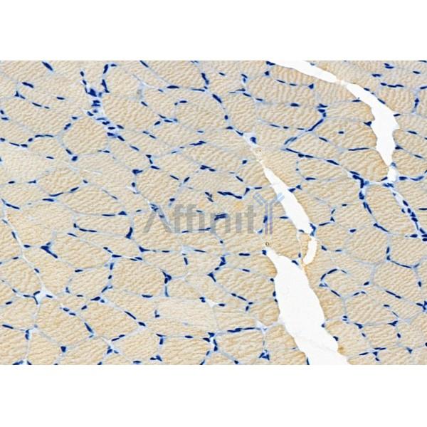 SLC1A4 Antibody - DF7178 at 1/100 staining Rat muscle tissue by IHC-P.