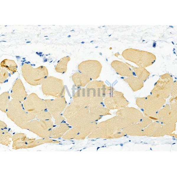 SLC1A4 Antibody - DF7178 at 1/100 staining Rat skin tissue by IHC-P.