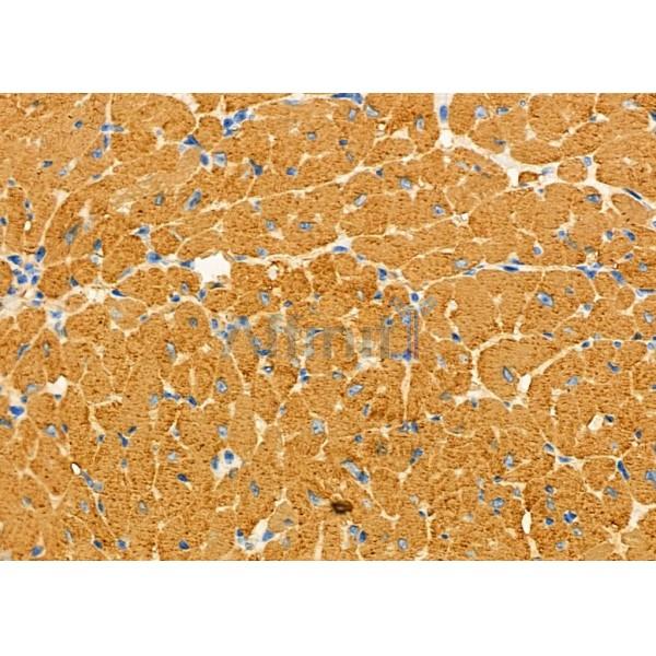 TPM2 Antibody - DF7183 at 1/100 staining Mouse heart tissue by IHC-P.