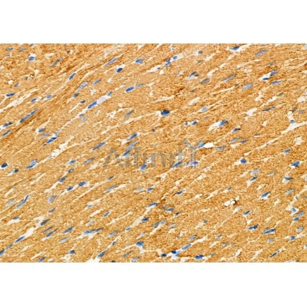 TPM2 Antibody - DF7183 at 1/100 staining Rat heart tissue by IHC-P.