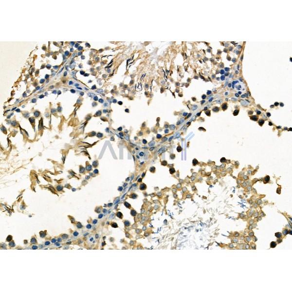Rabl2 Antibody - DF7408 at 1/100 staining Rat testis tissue by IHC-P.