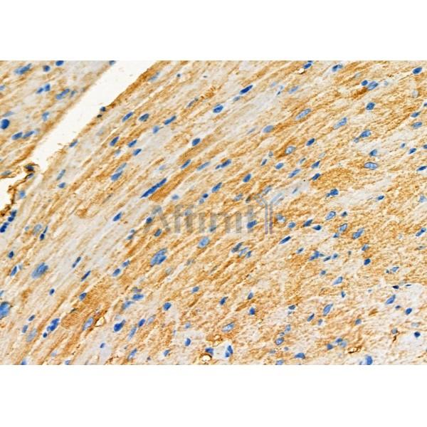 DAP Antibody - DF7628 at 1/100 staining Mouse heart tissue by IHC-P.