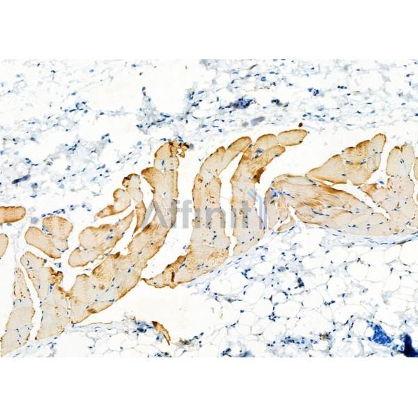 DAP Antibody - DF7628 at 1/100 staining Rat skin tissue by IHC-P.