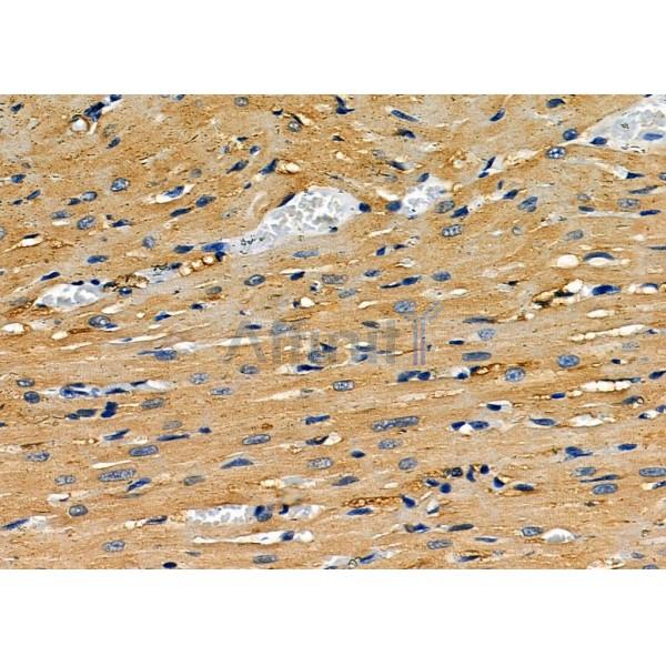 Pannexin-3 Antibody - DF7721 at 1/100 staining Rat heart tissue by IHC-P.