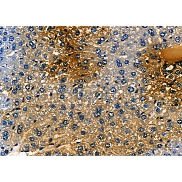 BMP9 Antibody - DF7758 at 1/100 staining Mouse liver tissue by IHC-P.