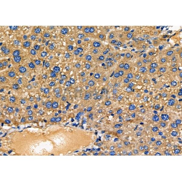 NDUFAF1 Antibody - DF7870 at 1/100 staining Mouse liver tissue by IHC-P.