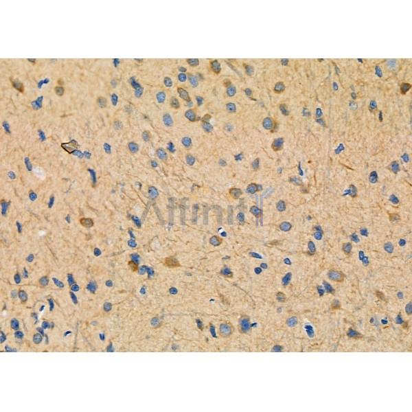 NDUFAF1 Antibody - DF7870 at 1/100 staining Rat brain tissue by IHC-P.