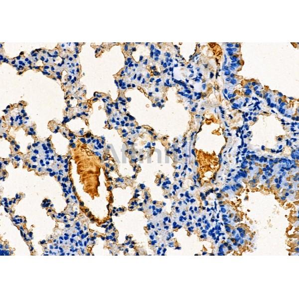 C17orf37 Antibody - DF7920 at 1/100 staining Mouse lung tissue by IHC-P.