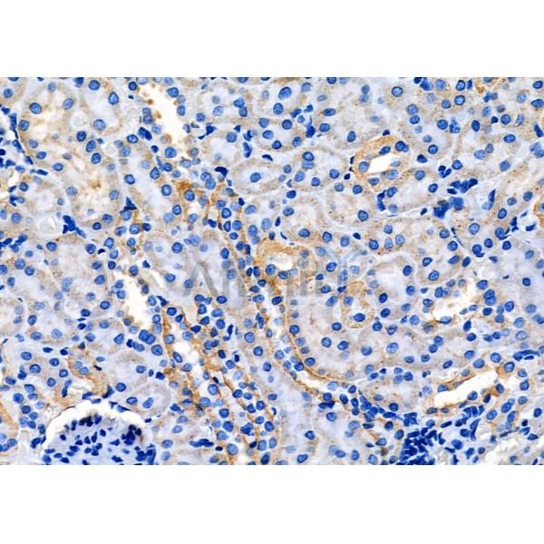 C17orf37 Antibody - DF7920 at 1/100 staining Rat kidney tissue by IHC-P.