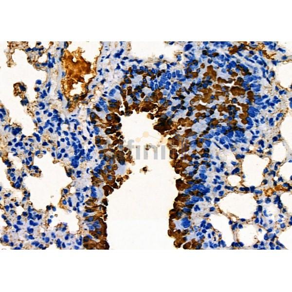 CGB Antibody - DF7923 at 1/100 staining Mouse lung tissue by IHC-P.