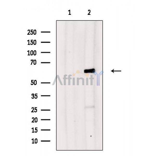 CDT1 Antibody - Western blot analysis of extracts from Rat brain, using CDT1 Antibody.