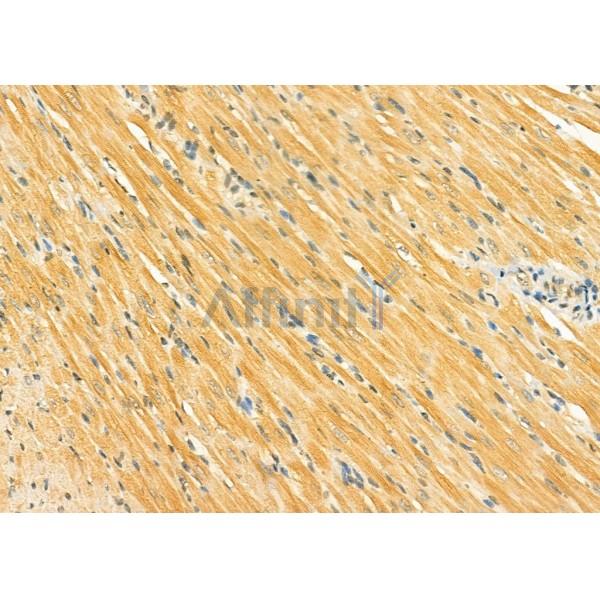 SIRT5 Antibody - DF8294 at 1/100 staining Rat heart tissue by IHC-P.