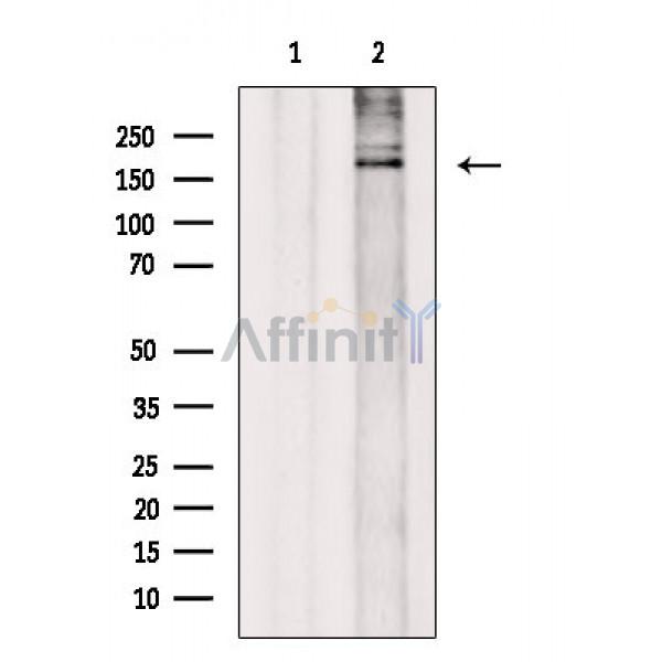 Brm Antibody - Western blot analysis of extracts from Rat brain, using Brm Antibody.