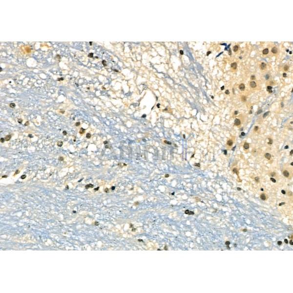 DMP1 Antibody - DF8825 at 1/100 staining Mouse brain tissue by IHC-P.