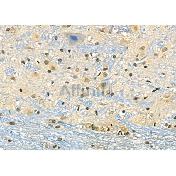 DMP1 Antibody - DF8825 at 1/100 staining Rat brain tissue by IHC-P.