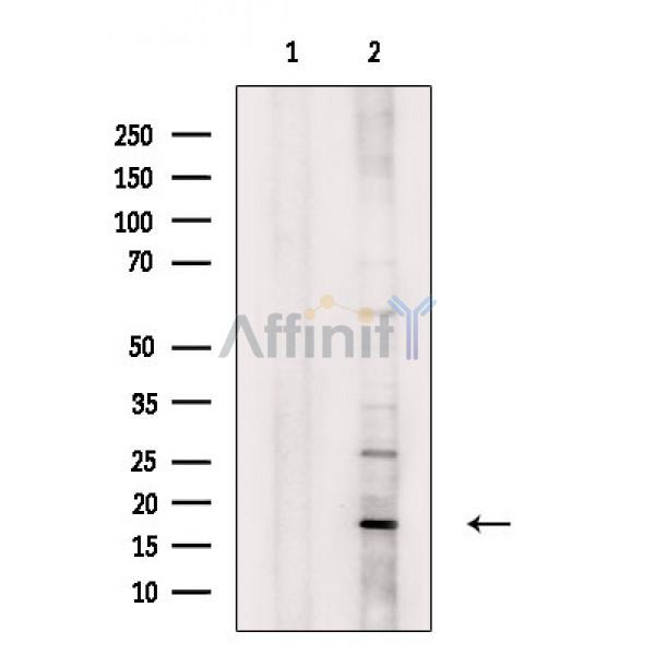 ECRG4 Antibody - Western blot analysis of extracts from Rat heart, using ECRG4 Antibody.
