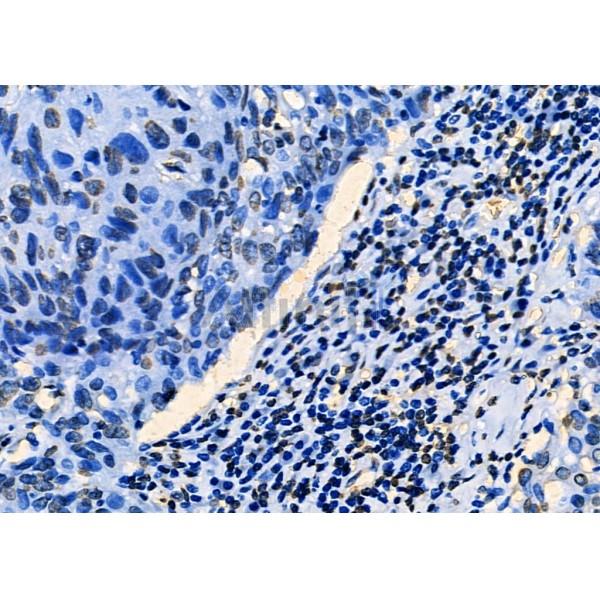 PKNOX2 Antibody - AF0567 at 1/100 staining Mouse spleen tissue by IHC-P.