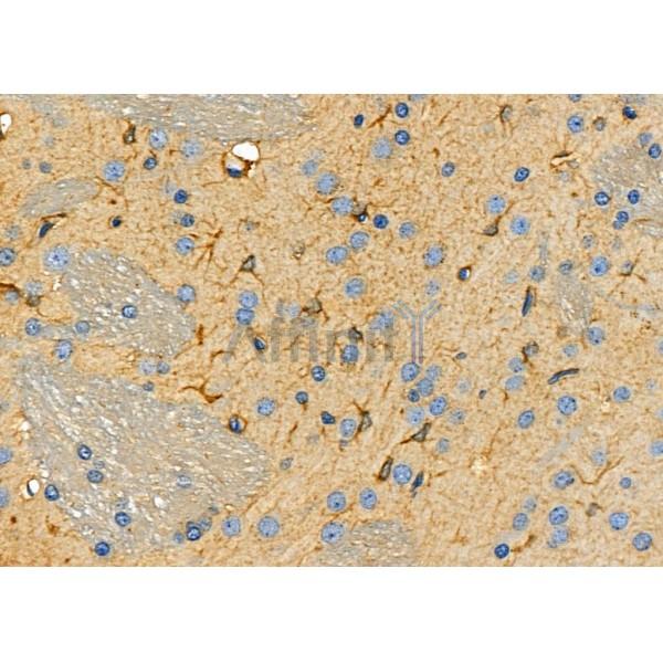 ALDOC Antibody - AF0696 at 1/100 staining Rat brain tissue by IHC-P.