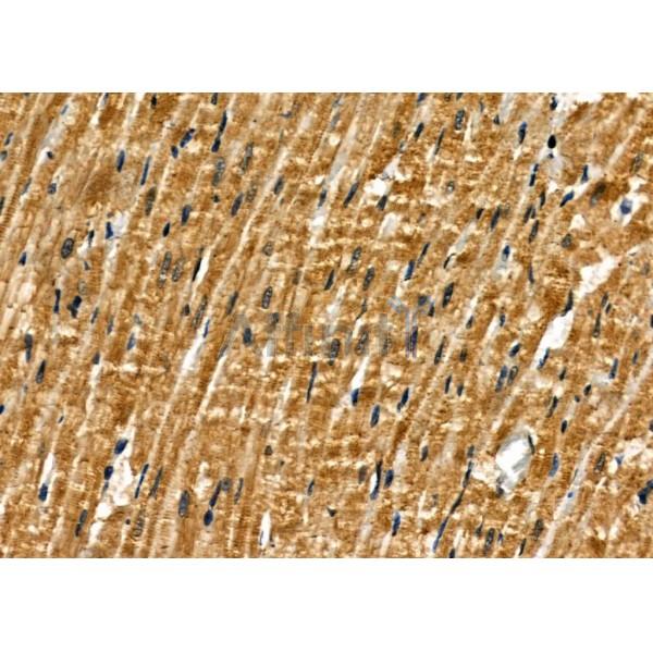 DOK6 Antibody - AF0767 at 1/100 staining Rat heart tissue by IHC-P.