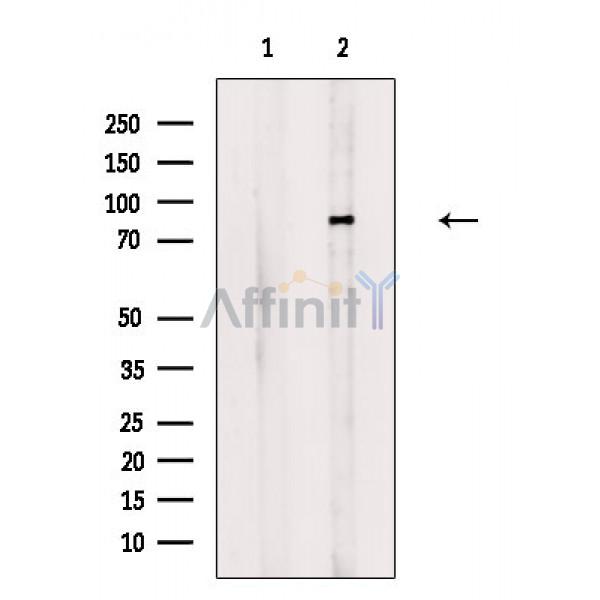 Phospho-MARK3 (Thr507) Antibody - Western blot analysis of extracts from B16F10 cells(H2O2 treatment), using Phospho-MARK3 (Thr507) Antibody.