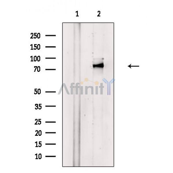 Phospho-Kv1.3/KCNA3 (Ser520) Antibody - Western blot analysis of extracts from COLO205 cells, using Phospho-Kv1.
