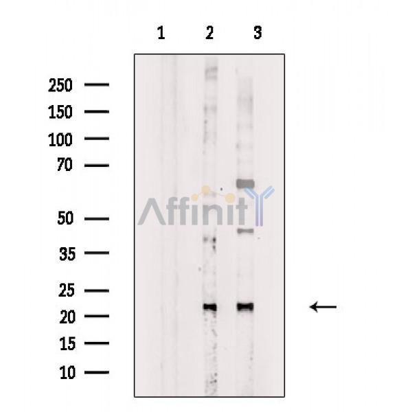 Phospho-SAR1A (Thr139) Antibody - Western blot analysis of extracts from various samples, using Phospho-SAR1A (Thr139) Antibody.
