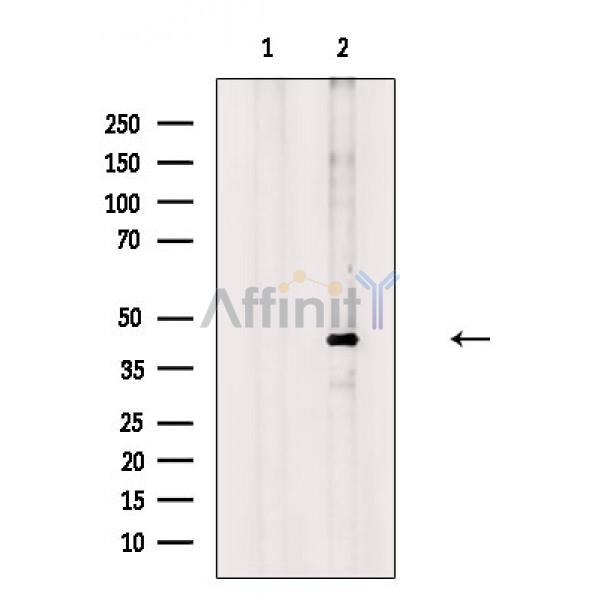 Phospho-PAR4 (Thr163) Antibody - Western blot analysis of extracts from PC12(UV treatment), using Phospho-PAR4 (Thr163) Antibody.