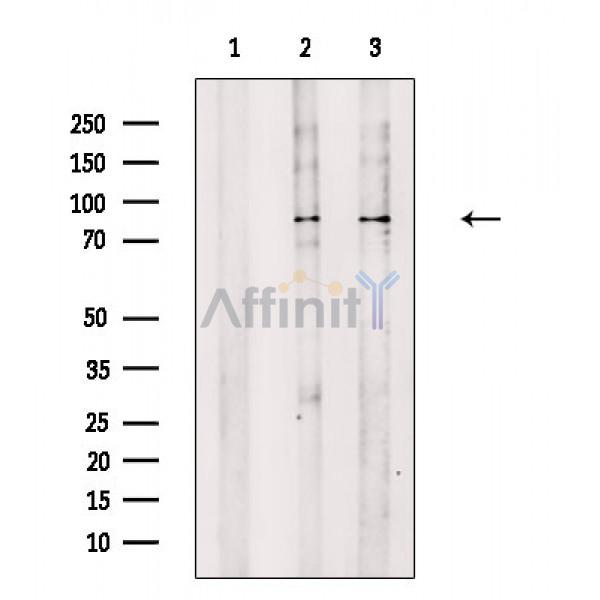 beta Catenin Antibody - Western blot analysis of extracts from various samples, using beta Catenin Antibody.