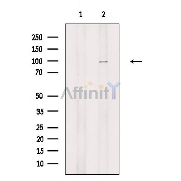 NFAT1 Antibody - Western blot analysis of extracts from Rat testis, using NFAT1 Antibody.