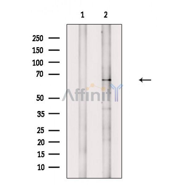 Phospho-IL-1R alpha /CD121 alpha (Tyr496) Antibody - Western blot analysis of extracts from Mouse brain, using Phospho-IL-1R alpha /CD121 alpha (Tyr496) Antibody.
