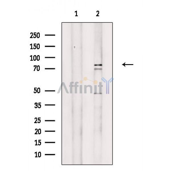 CCNT2 Antibody - Western blot analysis of extracts from HepG2 cells(H2O2 treatment), using CCNT2 Antibody.