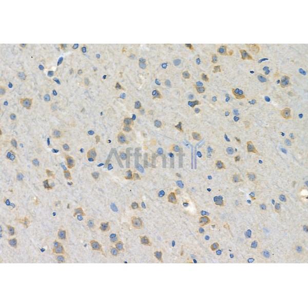Galectin 1 Antibody - DF2383 at 1/100 staining Rat brain tissue by IHC-P.