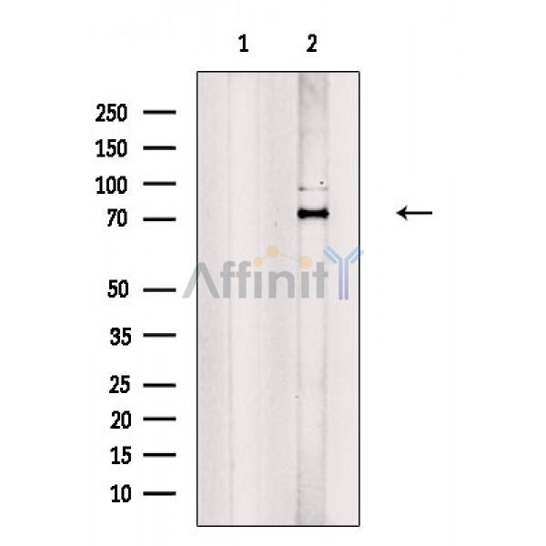 TBR1 Antibody - Western blot analysis of extracts from Rat brain, using TBR1 Antibody.
