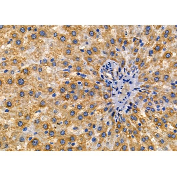 IL12RB1 Antibody - DF2508 at 1/100 staining Rat liver tissue by IHC-P.