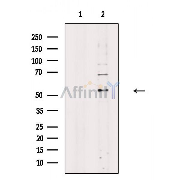 ING1 Antibody - Western blot analysis of extracts from A549 cells, using ING1 Antibody.