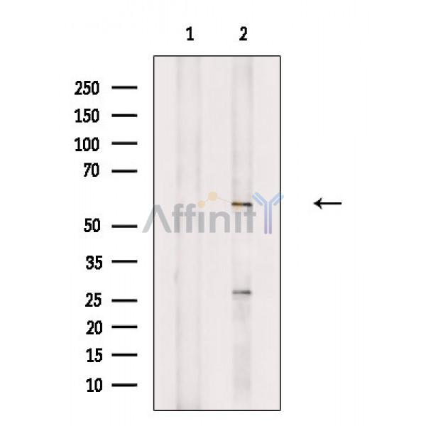 PCTK1 Antibody - Western blot analysis of extracts from A549 cells, using PCTK1 Antibody.